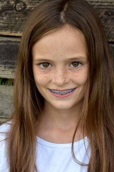 early orthodontic treatment